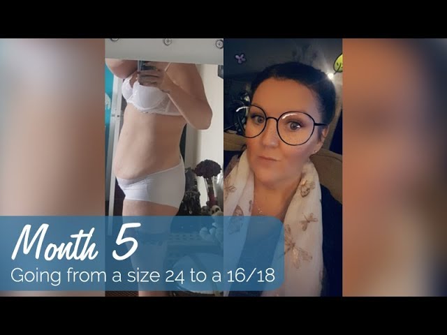 Mini Tummy Tuck Video (Mini Abdominoplasty) - SF Bay Area - 27