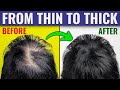 Grow THIN Hair Into THICK Hair - Dr. Berg