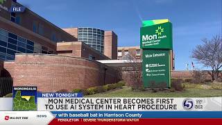 Morgantown hospital first in U.S. to use new AI-assisted technology during heart rhythm procedure