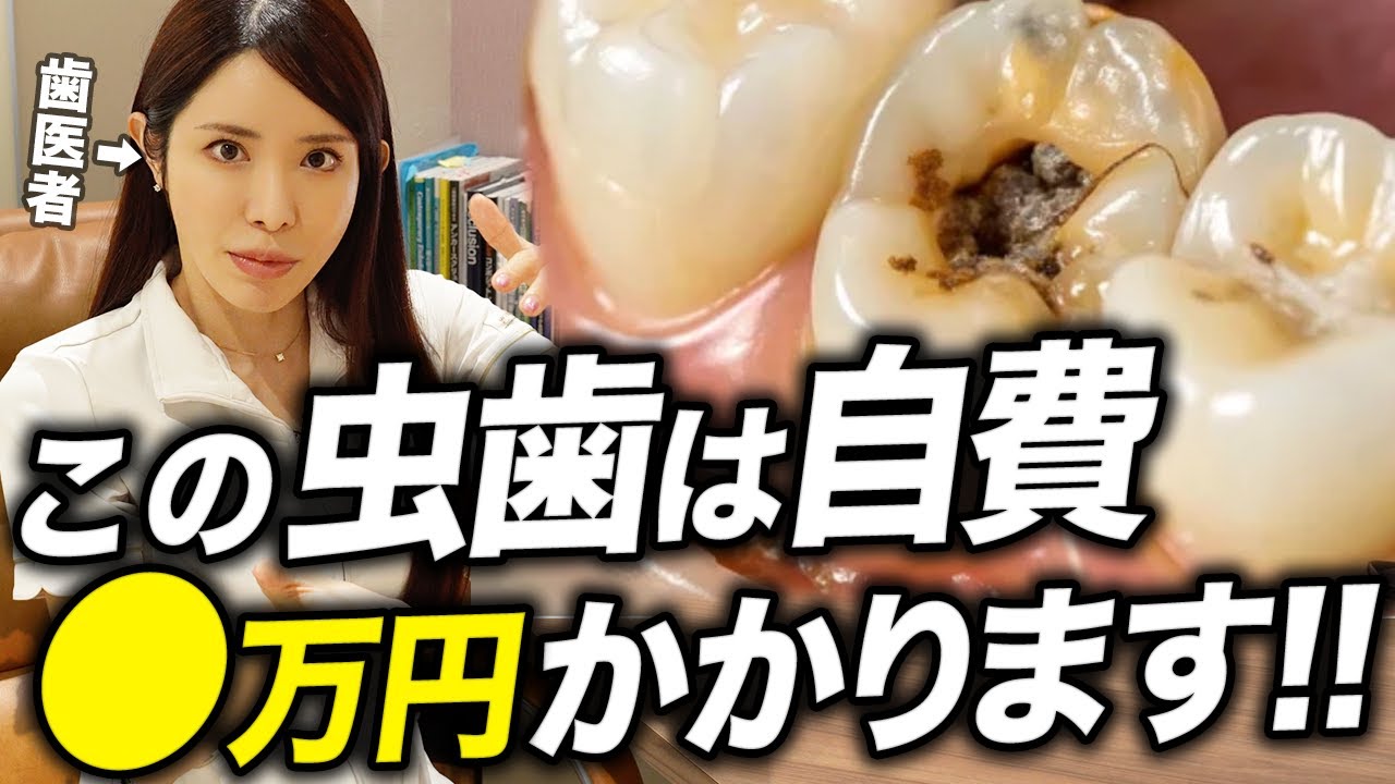 「その虫歯いくらで治る？」保険診療と自由診療で値段が変わります。【歯医者 / ラバーダム / 根管治療】