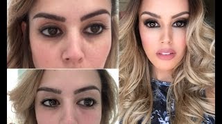 Sob grandes olhos pretas bolsas os