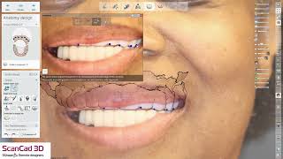 Celebrity 3shape ULAOX Profile