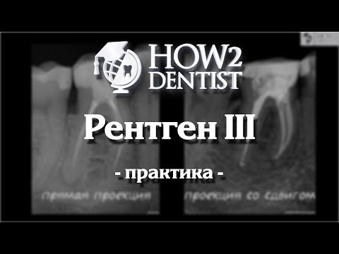 Как правильно делать прицельные снимки / How to Dentist