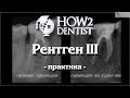 Как правильно делать прицельные снимки / How to Dentist