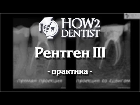 Видео: Для чего делают периапикальные рентгенограммы?