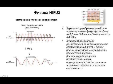 ОСНОВЫ ТЕХНОЛОГИИ HIFUS