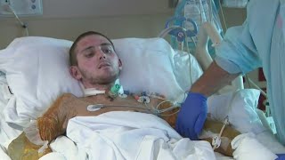 Kendall fireworks accident victim with dreams of becoming Marine gets special surprise