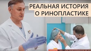 ⭐️Ринопластика 👍 Реальная история 👍 отзыв о пластика носа пластический хирург Павел Денищук