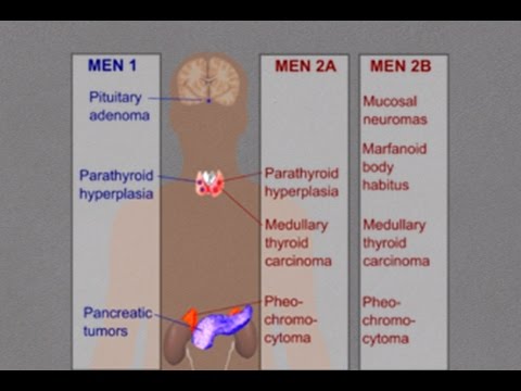 Video: Flere Endokrine Neoplasier Type 1: Omfattende Analyse Av En Stor Database Med Florentinske Pasienter