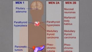 MEN 1 (Wermer Syndrome)