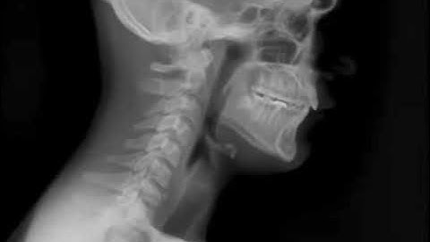 Dynamic Digital Radiography (DDR) Musculoskeletal