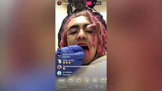 Lil Pump Gets Wisdom Tooth Pulled Out Hilarious