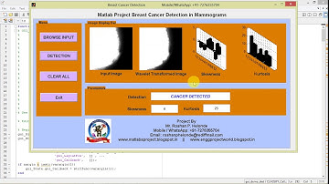 Matlab Project Breast Cancer Detection in Mammograms using Image Processing Full Source Code