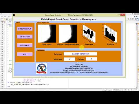 Matlab Project Breast
