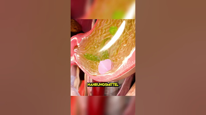 Wenn du einen Kaugummi isst, bleibt er dann jahrelang in deinem Magen? 🍬 (Credits:@zackdfilms)