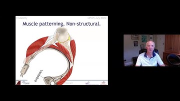 Shoulder Instability