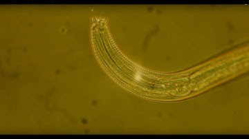 A Thing of Beauty: Antarctic Worm