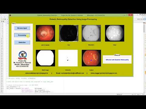 Diabetic Retinopathy Detection Using Image Processing Matlab Project Code