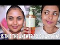 DOES PIXI TREAT HYPERPIGMENTATION? I USED HYPED PIXI PRODUCTS FOR 30 DAYS TO FIND OUT!