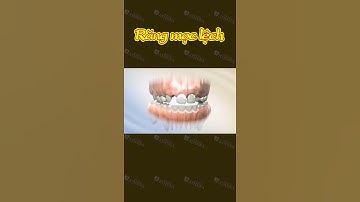 [3D] RĂNG MỌC LỆCH || Nha Khoa Quốc Tế Athena