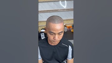 Cắt bỏ nỗi lo hói đầu , hói chữ m #xămtóc #scalp #reviewxămtóc #xămchântóc