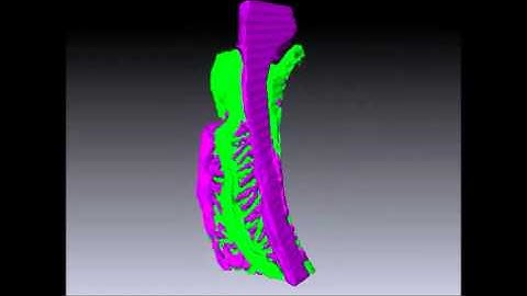 Scientific Reports : Three-dimensional architecture of podocytes revealed by block-face scanning...