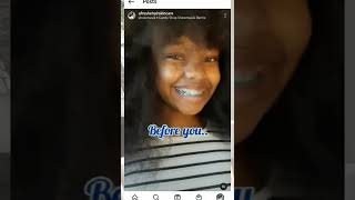 NEW Instagram PIN 📌 feature is HERE | Quick tutorial #shorts #instagrampin #newfeatures