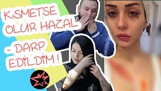 HAZAL BABALIK NEDEN DARP RAPORU ALDI? | iPhone XS Max Çekilişi