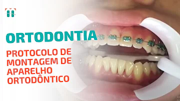 O que é a montagem do aparelho?