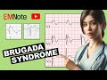 Brugada syndrome