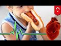 Brugada syndrome kids heart stops beating after eating hot dog  tomonews