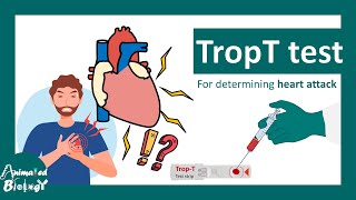 TropT test | What if Trop T test is positive? | Troponin T blood test