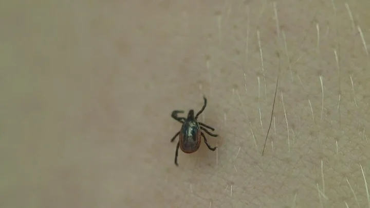 Lyme disease cases on the rise in parts of Michigan