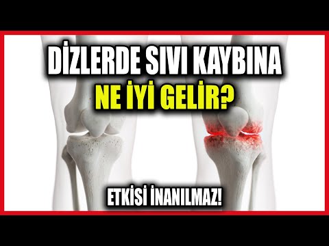 1 Ayda Dizlerdeki Sıvı Kaybından Kolayca Kurtulun!