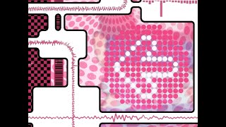 senpai erect remix (official teaser) chart Resimi