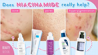 Niacinamide + Panthenol for Reducing Large Pores, Hyperpigmenation, Acne & More!
