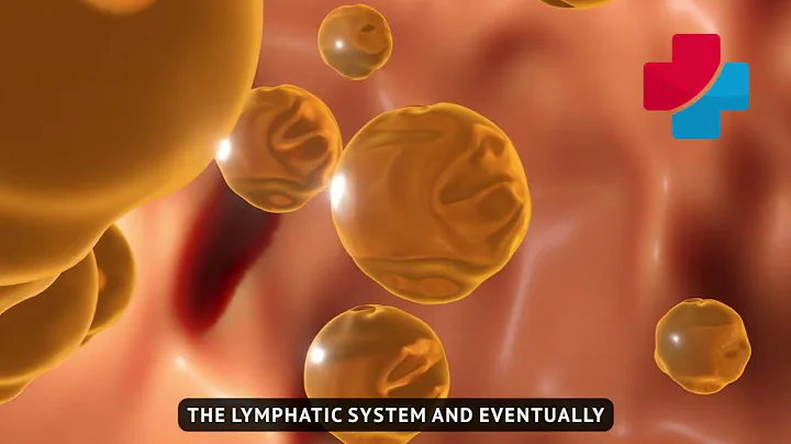 How Does Laser-like Lipo Work?