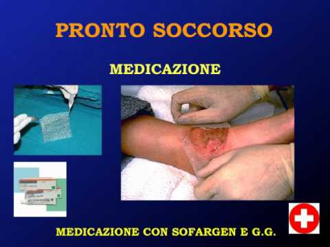 Ustioni Prof Dini chirurgia plastica pancia piatta