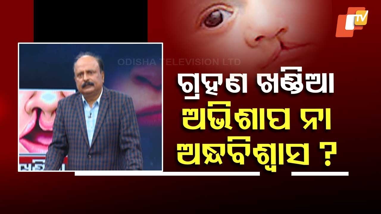 Doctor Doctor | What Is The Right Age For Surgery For Birthmarks? Know Plastic Surgeon's View