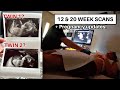 WE&#39;RE HAVING TWINS? 12 + 20 WEEK ULTRASOUND BABY SCANS + PREGNANCY UPDATES / Eltoria