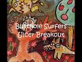 Miniature de la vidéo de la chanson Ulcer Breakout