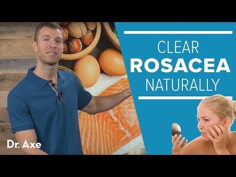 Rosacea Treatment: Help Clear Redness Naturally in 7 Steps