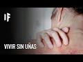 ¿Qué pasaría si los humanos no tuviéramos uñas?