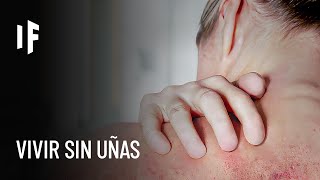 Thumbnail image for ¿Qué pasaría si los humanos no tuviéramos uñas?
