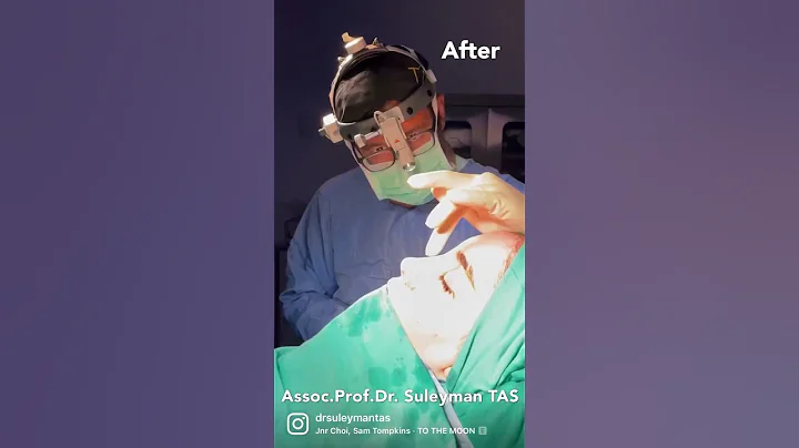 Give Me The Ideal Nose | Operation Room - DayDayNews
