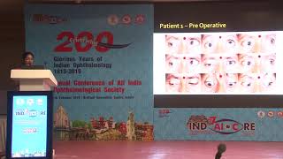 AIOC2019 FP 576 Squint Contralateral eye surgery in third nerve palsy Dr Sathya T Ravilla