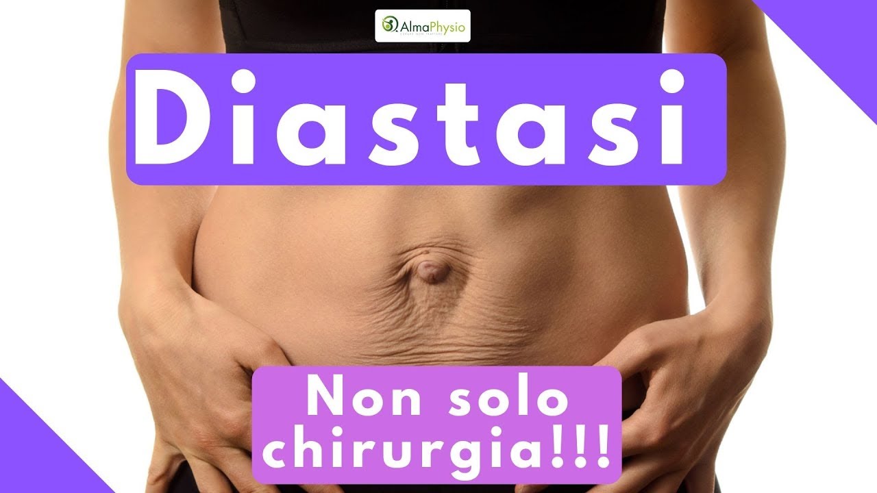 Diastasi: non solo chirurgia! tendinopatia cronica