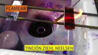 TINCION ZIEHL NEELSEN