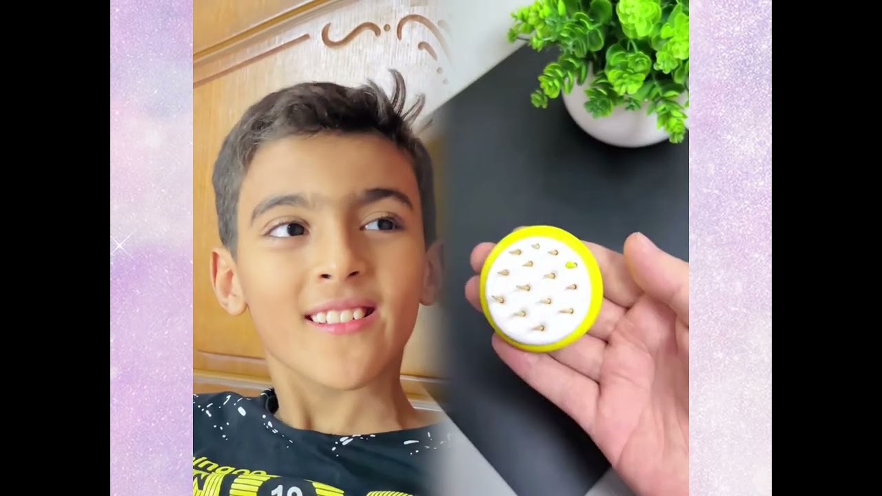 #الطفل الاعمى المعجزه #محضوره_من_الاكسبلور_والمشاهدات #علاوي_مارتن #اكسبلور 15_w