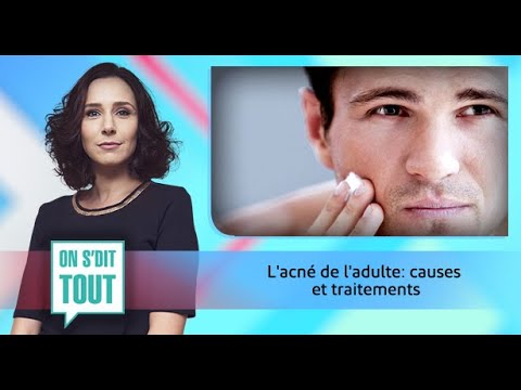 Vidéo: Acné Chez L'adulte: Causes Et Options De Traitement